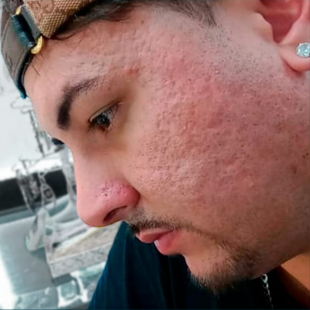 Antes_Rosto1 Antes_Rosto1