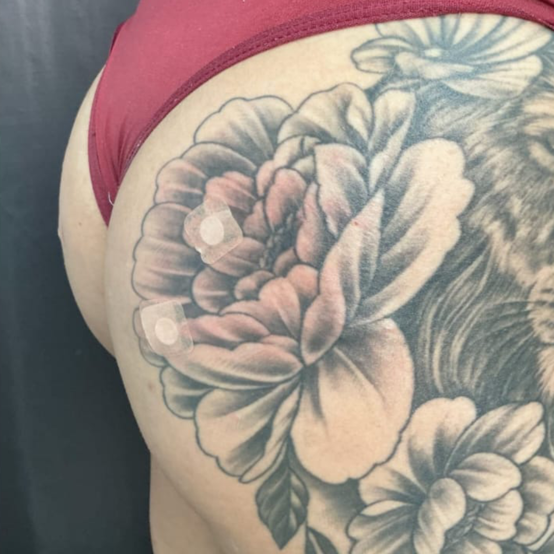 Depois_Gluteo1 Depois_Gluteo1