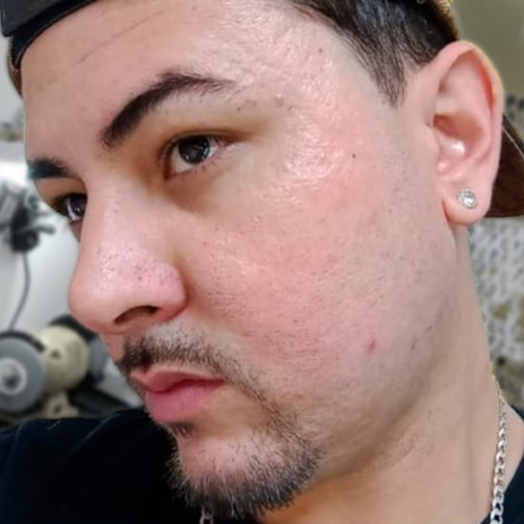 Depois_Rosto1 Depois_Rosto1